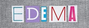 Oedema